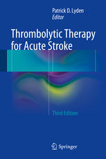 Thrombolytic Therapy for Acute Stroke 2014