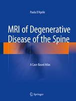 MRI of Degenerative Disease of the Spine: A Case-Based Atlas 2014