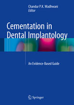 Cementation in Dental Implantology: An Evidence-Based Guide 2014