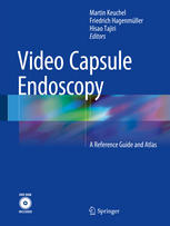 Video Capsule Endoscopy: A Reference Guide and Atlas 2015
