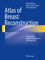 Atlas of Breast Reconstruction 2014