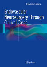 Endovascular Neurosurgery Through Clinical Cases 2014