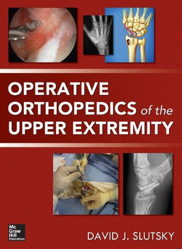 Operative Orthopedics of the Upper Extremity 2014