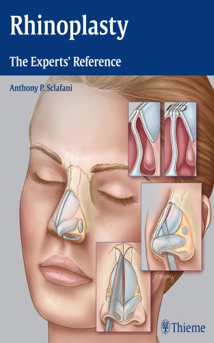 Rhinoplasty: The Experts' Reference 2015