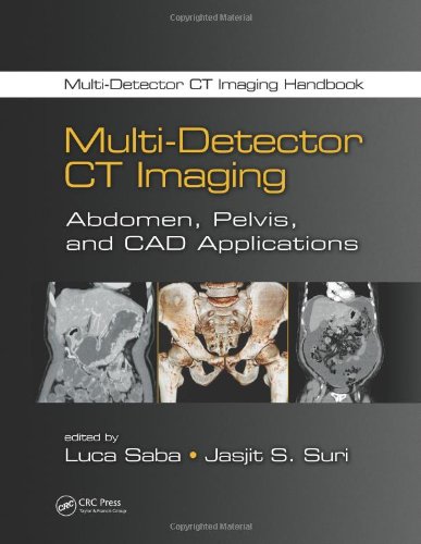 Multi-Detector CT Imaging: Abdomen, Pelvis, and CAD Applications 2013