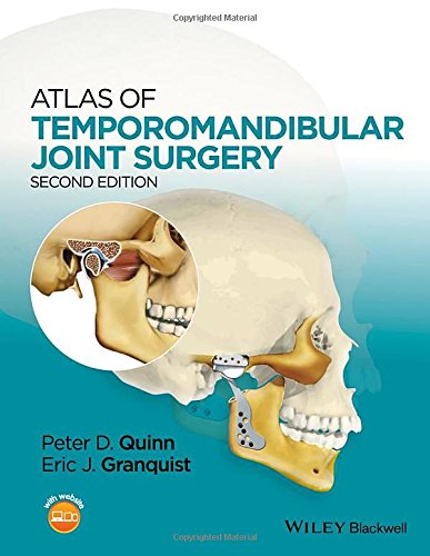 Atlas of Temporomandibular Joint Surgery 2015