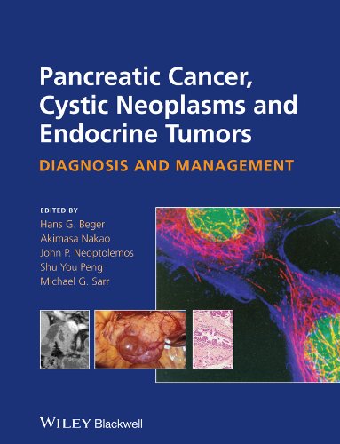 Pancreatic Cancer, Cystic Neoplasms and Endocrine Tumors: Diagnosis and Management 2015