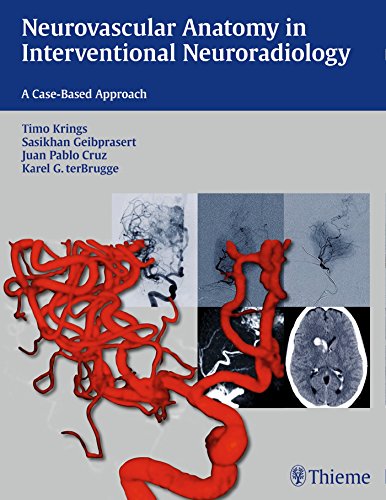Neurovascular Anatomy in Interventional Neuroradiology: A Case-Based Approach 2015