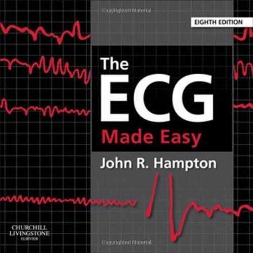 The ECG Made Easy 2013
