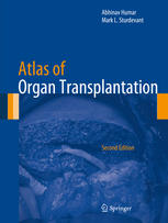 Atlas of Organ Transplantation 2015