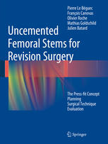 Uncemented Femoral Stems for Revision Surgery: The Press-fit Concept - Planning - Surgical Technique - Evaluation 2015