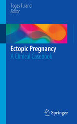 Ectopic Pregnancy: A Clinical Casebook 2015
