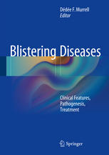 Blistering Diseases: Clinical Features, Pathogenesis, Treatment 2015