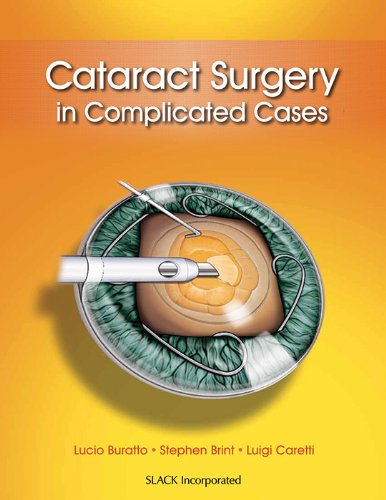 Cataract Surgery in Complicated Cases 2013