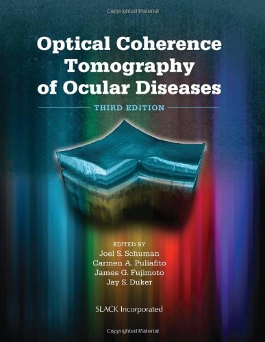 Optical Coherence Tomography of Ocular Diseases 2013