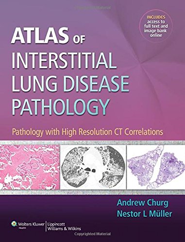 Atlas of Interstitial Lung Disease Pathology: Pathology with High Resolution CT Correlations 2013