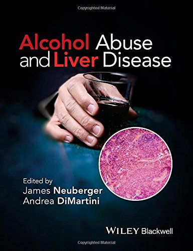 Alcohol Abuse and Liver Disease 2015