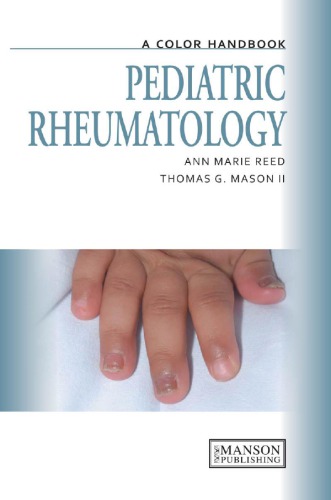 Pediatric Rheumatology: A Color Handbook 2012