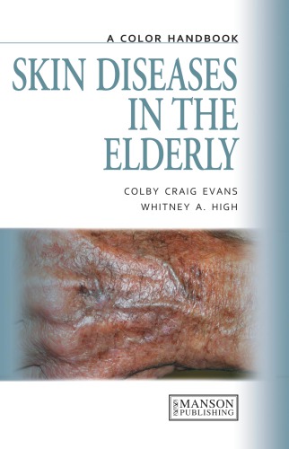 Skin Diseases in the Elderly: A Color Handbook 2011