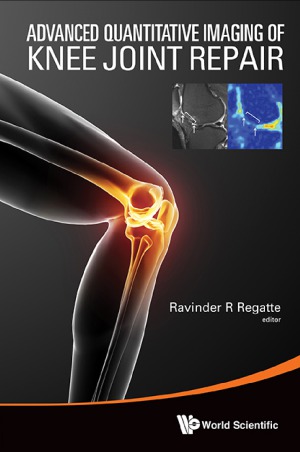 Advanced Quantitative Imaging of Knee Joint Repair 2014