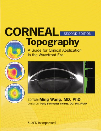 Corneal Topography: A Guide for Clinical Application in the Wavefront Era 2012