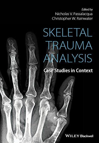 Skeletal Trauma Analysis: Case Studies in Context 2015