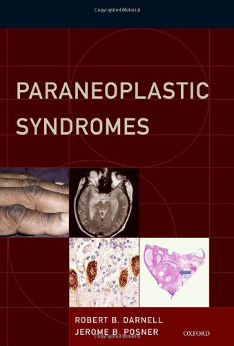 Paraneoplastic Syndromes 2011