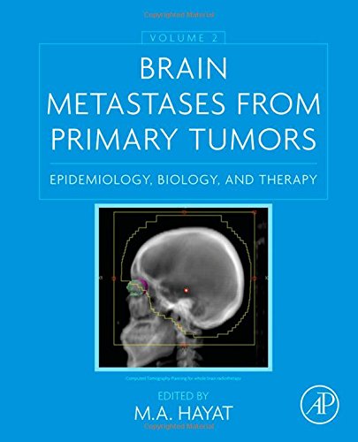 Brain Metastases from Primary Tumors, Volume 2: Epidemiology, Biology, and Therapy 2015