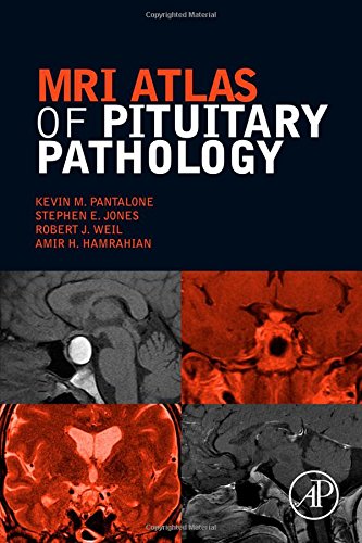 MRI Atlas of Pituitary Pathology 2015