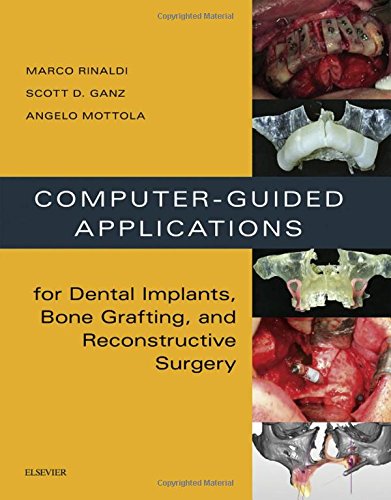 کاربردهای کامپیوتری: برای ایمپلنت های دندانی، پیوند استخوان و جراحی ترمیمی