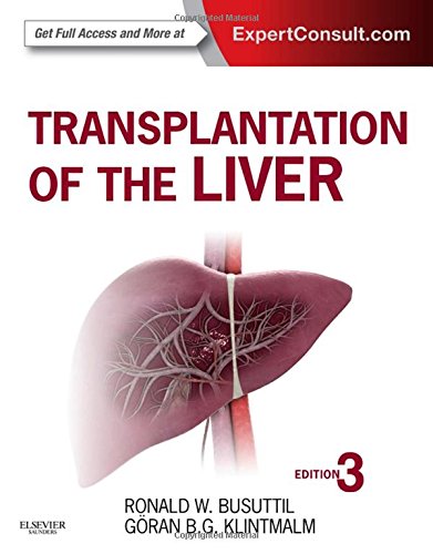 Transplantation of the Liver 2015