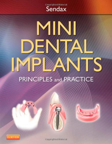 Mini Dental Implants: Principles and Practice 2012