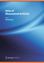 Atlas of Rheumatoid Arthritis 2015