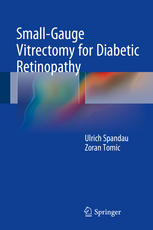Small-Gauge Vitrectomy for Diabetic Retinopathy 2015