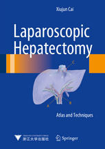 Laparoscopic Hepatectomy: Atlas and Techniques 2015