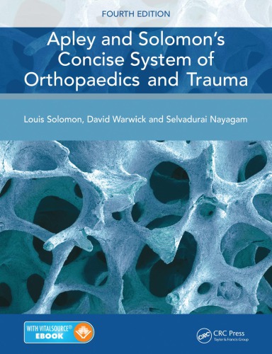 Apley and Solomon's Concise System of Orthopaedics and Trauma 2014
