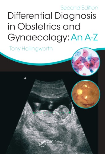 Differential Diagnosis in Obstetrics & Gynaecology: An A-Z, Second Edition 2015