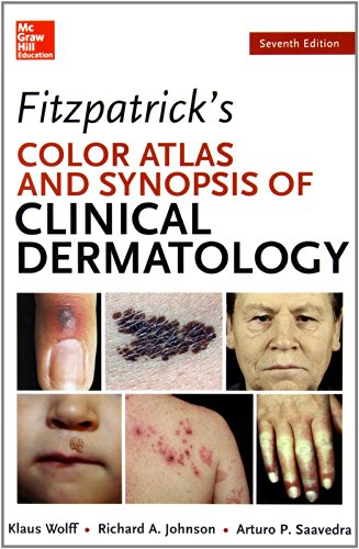 Fitzpatricks Color Atlas and Synopsis of Clinical Dermatology, Seventh Edition 2013