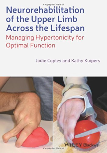 Neurorehabilitation of the Upper Limb Across the Lifespan: Managing Hypertonicity for Optimal Function 2014