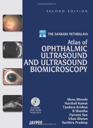 Atlas of Ophthalmic Ultrasound and Ultrasound Biomicroscopy 2013
