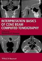 Interpretation Basics of Cone Beam Computed Tomography 2013