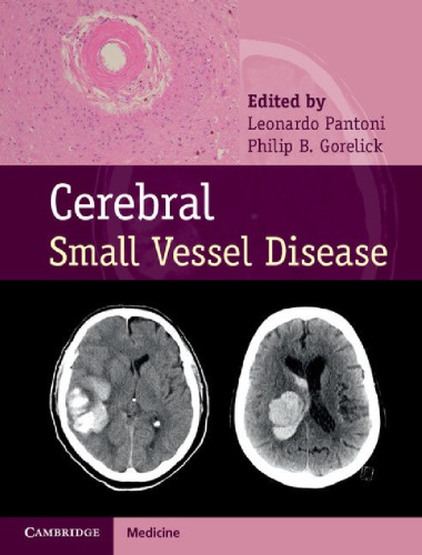 Cerebral Small Vessel Disease 2014