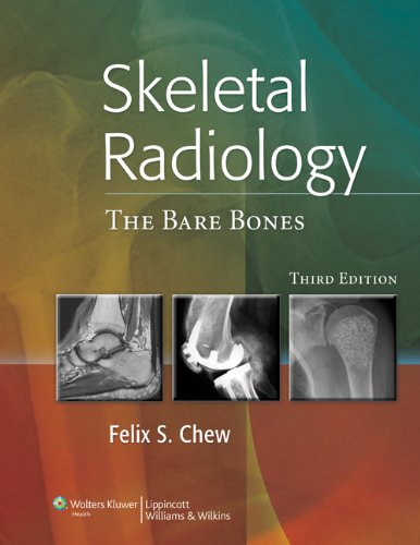 Skeletal Radiology: The Bare Bones 2010