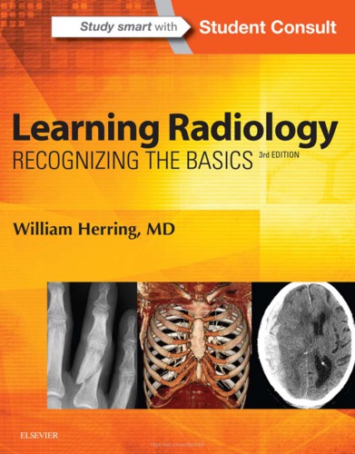 Learning Radiology: Recognizing the Basics 2015