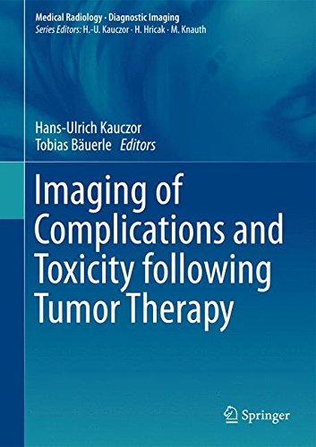 Imaging of Complications and Toxicity following Tumor Therapy 2015