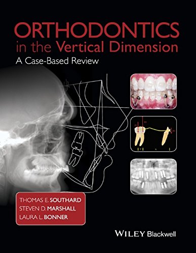 Orthodontics in the Vertical Dimension: A Case-Based Review 2015