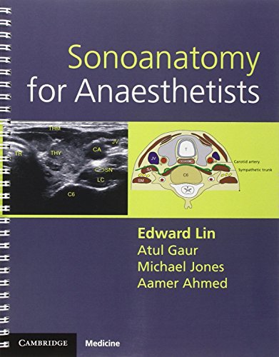Sonoanatomy for Anaesthetists 2012