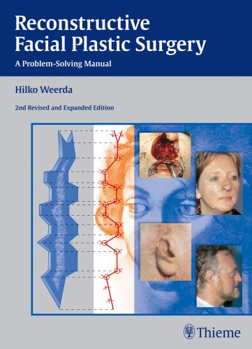 Reconstructive Facial Plastic Surgery: A Problem-solving Manual 2014