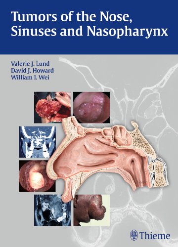Tumors of the Nose, Sinuses and Nasopharynx 2013