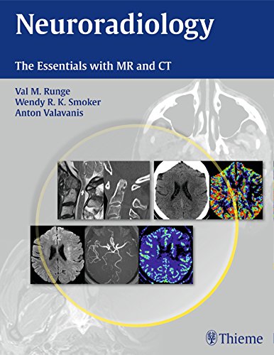 Neuroradiology: The Essentials with MR and CT 2015